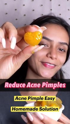 Skin Care Diy, Pimple Free Skin, How To Clear Pimples, Brown Spots On Skin, How To Reduce Pimples, Pimples Remedies, Natural Face Skin Care, Natural Acne Remedies