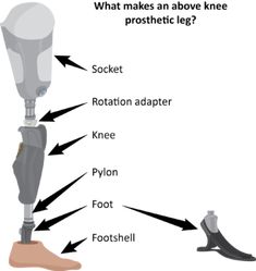 a diagram showing the parts of a foot and what makes an above knee prosthetic leg