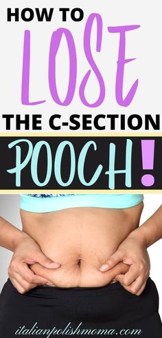 How a new mom can lose the c-section belly pooch C Section Pouch, Belly Pouch, Lower Belly Pooch, Mommy Pooch, C Section Scars, Mom Belly