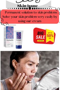 Have you been suffering from skin problems for a long time? Your skin is unusually swollen or damaged So use our product now without delay Your problem will be solved for sure #how_to_solve_face_skin_problems #how_to_solve_skin_allergy_problem #skin_issue_solve_fast #skin_issue_solve_for_cream #skin_issue_solve_for_face #skin_issue_solve_girl