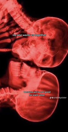 an x - ray image with the words, no one wants us together because we're not good for each other