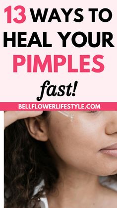 Does Toothpaste Get Rid Of Pimples? Overnight Clear Skin, Pimple Hacks, Pimple Remedies, Girl With Acne, Acne Journey, Pimples On Scalp, Clear Skin Overnight, Big Pimple