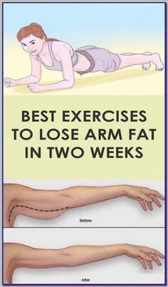 Arm Fat Exercises, Lose Arm Fat Fast, Arm Toning Exercises, Flabby Arms, Arm Muscles, Best Exercises