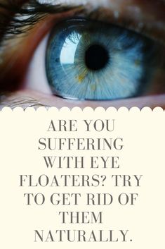 How To Get Rid Of Floaters In Your Eyes, How To Get Rid Of Eye Floaters, Eye Floaters Remedies Natural Treatments, Eye Floaters Remedies, Floaters In The Eye, Yoga Mindset, What Causes Eye Floaters, Eye Floaters Causes, Eye Health Remedies