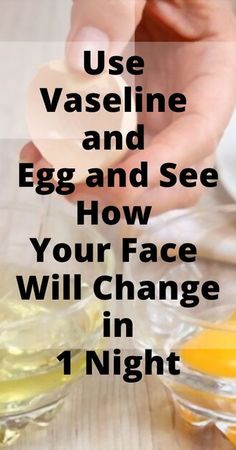 Vaseline Uses For Face, Vaseline For Face, Face Wrinkles Remedies, Wrinkles Remedies Face, Home Remedies For Wrinkles, Wrinkle Remedies, Natural Face Skin Care, Face Wrinkles