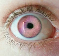 Pink Eye Color Contacts, Unique Eye Color Character Inspiration, Unnatural Eye Color, Fantasy Eye Color, Pink Eyes Aesthetic, Pink Eye Color, Unique Eye Color, Unique Eyes, Woman Eyes