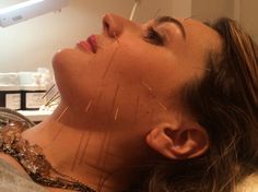 Facial Acupuncture Facial Acupuncture, Career Opportunities, Better Homes, Behind Ear Tattoo, Leadership, Facial