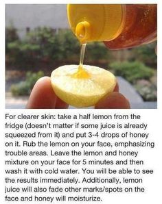 Obličejové Masky, Natural Acne, Beauty Remedies, Acne Remedies, Skin Remedies, Bohol, Natural Face, Diy Skin