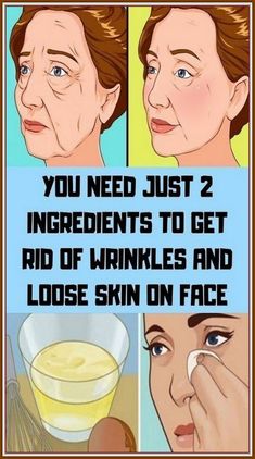 Face Wrinkles Remedies, Get Rid Of Wrinkles, Wrinkle Remedies, Face Wrinkles, Wrinkled Skin, Loose Skin, Les Rides