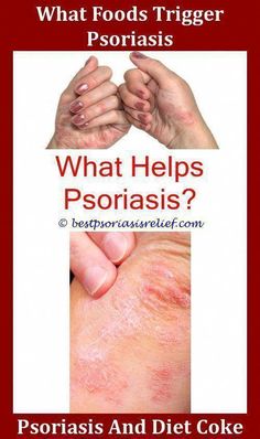 How to Get Rid of Warts Quickly - Are you looking for how to get rid of warts? Warts are a very common and annoying problem for over 50% of the population. They are caused by a virus called the human... What Causes Warts, Armpit Rash, How To Remove Warts, Remove Warts