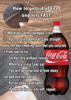 Despite claims that Coca-Cola is an effective solution for eliminating head lice, the evidence that it actually works isn't compelling. Lice Remedies, 1000 Lifehacks, Homemade Remedies, Simple Life Hacks, Diy Life Hacks, Useful Life Hacks, Health Remedies, Household Hacks