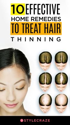 Treat Thinning Hair, Thining Hair, Thinning Hair Remedies, Dunner Wordend Haar, Back Of Head, Feminine Health, Hair Remedies For Growth, Hair Thinning