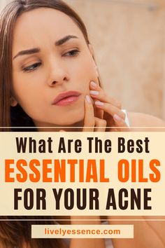 There are many essential oil blends on the market today that can be used to help reduce your acne. All with different properties but equally effective at getting rid of zits! To make sure you're using an appropriate combination for maximum effect, read through this post. #essentialoils #acne Manuka Oil, Get Rid Of Acne, Rid Of Acne