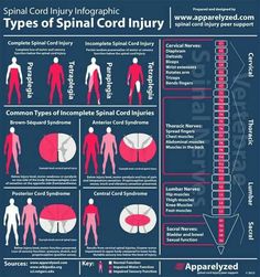 Spinal injury Spinal Cord Injuries, Pta School, Pa School, Medicine Student, Nursing Tips