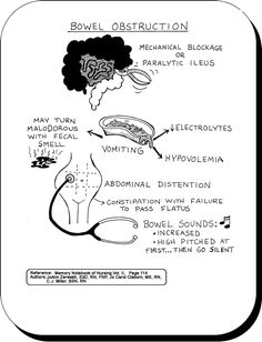 a diagram showing the different types of bone obstruction and how they are used to treat them