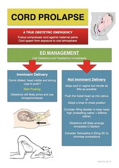 an info sheet with instructions on how to use the cord prolapse for medical purposes