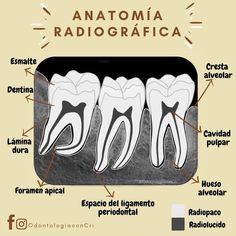 Dental Posters, Dental Aesthetics, Dentist Humor, Dental Facts