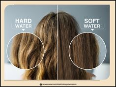 hard water make your hair fall out Hard Water, Water Damage, Bangalore, Cold Water, Make Your, Make It Yourself, Hair Styles