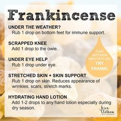 Frankincense Essential Oil Uses, Helichrysum Essential Oil, Doterra Essential Oils Recipes, Doterra Oil