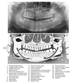 Registered Dental Hygienist, Dental Videos