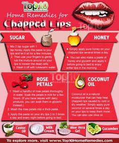 Remedies For Chapped Lips, Lips Remedies, Dry Lips Remedy, Chapped Lips Remedy, Sore Lips, Diy Lip Scrub, Diy Halloween Dekoration, Top 10 Home Remedies, Lip Scrubs