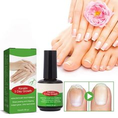 Welcome to my shop, please click for more best-selling products Ankoty Nail Care Solution Grey Nail Softening Thickening And Brightening Nail Care Solution 15ml Features: Adopting new technology developed, it is rich in herbal extracts, mild and non-irritating, and suitable for all types of nails. It nourishes and nails, while inhibiting growth and promoting nail growth. Nice quality nail care to . It can help the from recurring and spreading to other nails. The item contains herbal ingredients, Grey Nail, Sally Hansen Nails, Fungal Nail, Nail Repair, Nail Remover, Damaged Nails, Ingredient List, Nail Oil, Gray Nails