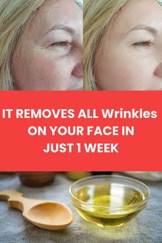 It removes all wrinkles on your face in just 1 week Wrinkles On Face, Best Skin Care Routine, Ageless Beauty, Wrinkle Remover