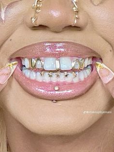 Gold Teeth Grills, Gold Grill, Gold Grillz