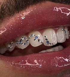 Unique Tooth Gems, Gem Hair, Crooked Teeth