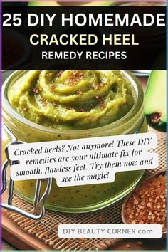 Say goodbye to dry, cracked heels with these 25 DIY homemade remedies. From foot soaks to heel treatments, these recipes help soften and repair damaged skin using natural ingredients. Whether you're dealing with heel fissures, cracked feet, or dry heels, these DIY remedies provide instant relief and long-term repair. Treat your feet to the care they deserve and heal cracked heels today! #CrackedHeelRemedies #FootSoak #DryHeels #HeelRepair Cracked Heel Remedy, Dry Skin Home Remedies, Heel Fissures, Cracked Heel Remedies, Heal Cracked Heels, Diy Foot Soak, Foot Soaks, Dry Cracked Heels