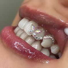 BLINGS ✨#gemstones Tooth Gem Placement, Pretty Teeth, Dental Jewelry, Grillz Teeth, Gem Tattoo, Diamond Teeth, Dope Jewelry Accessories, Tooth Gems, Diy Teething