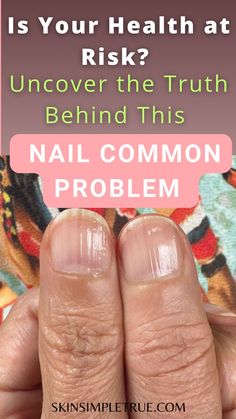 Click to read our derm's insights into what causes nail ridges, particularly nail ridges vertical warning signs. Explore how to get rid of nail ridges, nail ridges health meaning, fix ridges nail disorder, nail polish for ridges, how to fill and smooth nail ridges, skin care solutions, how to remove nail ridges, long healthy nails tips, nail diseases and disorders, nail care tips, nail health problems warning signs, nail changes health, deep nail ridges and more in this blog post. Healthy Nails Tips, Vertical Nail Ridges, Nail Health Problems, Long Healthy Nails, Nail Disorders, Diseases And Disorders, Nail Ridges