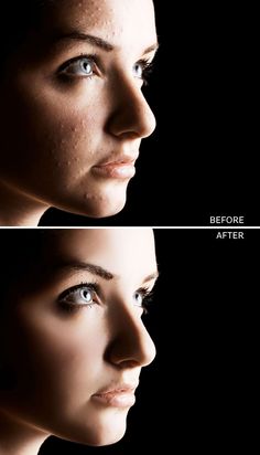 before and after images of a woman's face