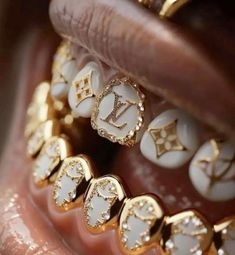 Gold Teeth Grills, Gold Teeth Grillz, Looks Hip Hop, Diamond Grillz, Xoxo Jewelry