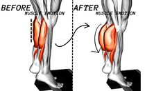 an image of the muscles before and after surgery