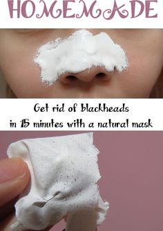 Get rid of blackheads in 15 minutes with a natural mask | Natural Beauty Make Up Diy, Rid Of Blackheads, Natural Mask, Get Rid Of Blackheads