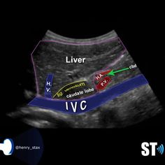 an x - ray shows the location of livers