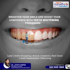 #dentalimplants #dentist #dentistry #dental #smile #teeth #dentalcare #dentalclini #oralhealth #aaradhyadentalcare Dental Implants Creative Ads, Toothache Remedies, Teeth Whitening Procedure