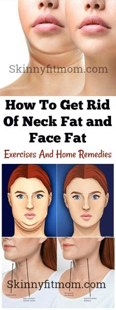 Face Fat Exercises, Chin Exercises, Face Fat, Neck Exercises, Face Exercises, Face Lifting, Facial Exercises, Face Yoga