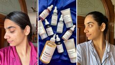 Here Are 11 Best The Ordinary Products For Acne Scars That CHANGED My Skin The Ordinary Products For Acne, Ordinary Products For Acne, Best The Ordinary Products, Products For Acne, Ordinary Products, Acne Scar, My Skin