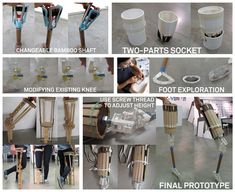 The check point of my study was, if a child's limb is (above-knee) amputated, one of the growth plates near the knee will be removed so their stump will remain sized as a child's even after they become adults. Once the thigh socket fit into the amputated limb, there will mainly be height changes between the socket and knee, and between the knee and the ankle. A Child, The Knee