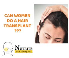 Hair Transplant is not only an option for men now women can also do it some of the surgical techniques are used to treat alopecia related issues with Hair Transplantation hairs are re-grown on your bald or hair fall area with the help techniques like FUT, FUE.Nutrite in Delhi provides Best Hair Transplant in Delhi. #hairtransplant Hair Regrowth Treatments, Male Pattern Baldness, Hair Fall