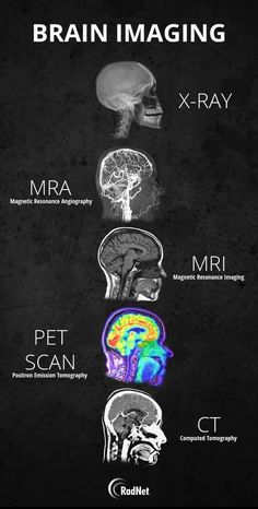 the brain is shown with different types of mris and their functions in each region