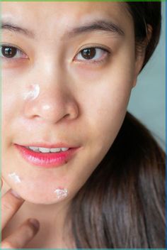 We asked dermatologists to help break down the difference between benzoyl peroxide vs salicylic acid, plus the best benzoyl peroxide and salicylic acid acne treatments to use. #beautyhacks #beautytips #makeuphacks #acne Comedonal Acne, Mild Acne, Acne Treatments, Salicylic Acid Acne, Acne Oil, Benzoyl Peroxide, Acne Blemishes, Clear Acne, Smoother Skin