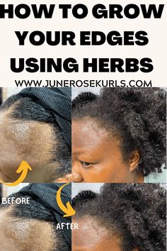 How to grow your edges using herbs for hair growth. Regrow Edges, Hair Growth Regimen, African Herbs, Rosemary Hair Growth, Regrow Hair Naturally, Thick Natural Hair, Herbs For Hair, Ayurvedic Oil