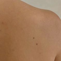 the back of a woman's shoulder with small brown dots on her left arm