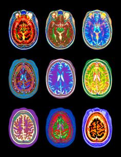 multiple mri images showing different areas of the human's brain and their corresponding functions