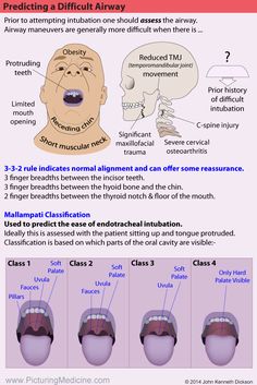 an info sheet describing the different types of facial expressions and their corresponding features in this graphic