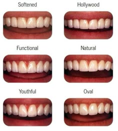 Toothy Smile, Teeth Whitening Homemade