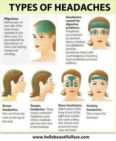 Different Types Of Headaches, Bolesti Chrbta, Headache Types, Reiki Meditation, Migraine Relief, Headache Relief, Migraine Headaches, Medical Knowledge, Health Info